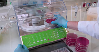 easySpiral Dilute - Interscience - 培养皿