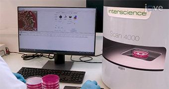 Scan 4000 - 菌落计数