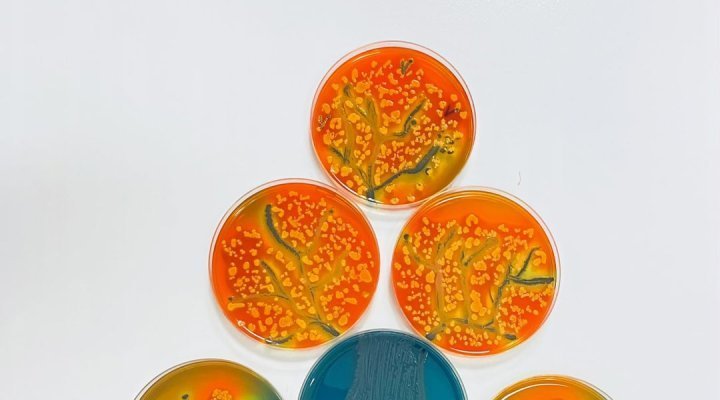 INTERSCIENCE 支持琼脂艺术 