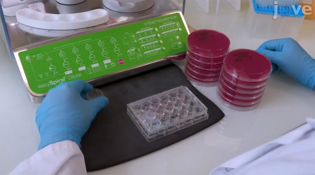 JoVE视频期刊 - 接种 & 计数