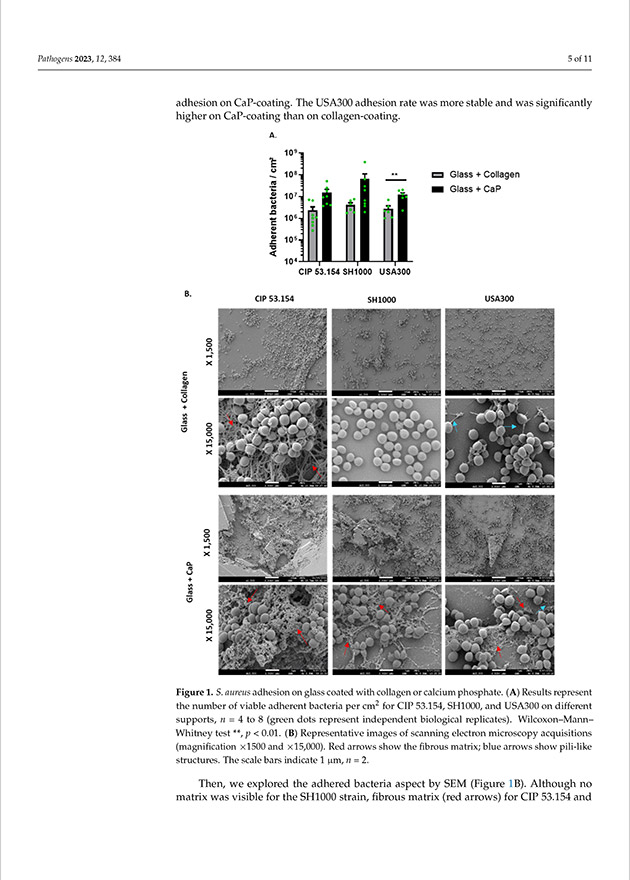 金黄色葡萄球菌在模拟骨骼环境的人造表面上的行为（英文）